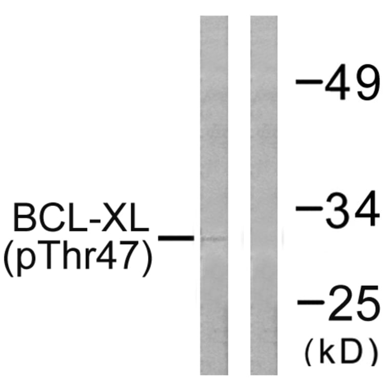 Western Blot - Anti-BCL-XL (phospho Thr47) Antibody (A0775) - Antibodies.com
