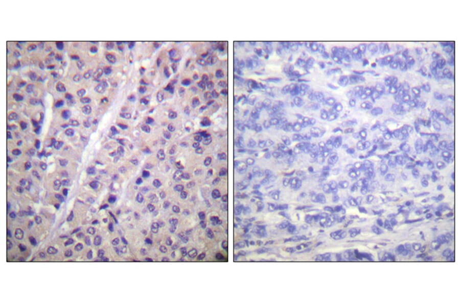 Immunohistochemistry - Anti-A-RAF (phospho Tyr302) Antibody (A0770) - Antibodies.com