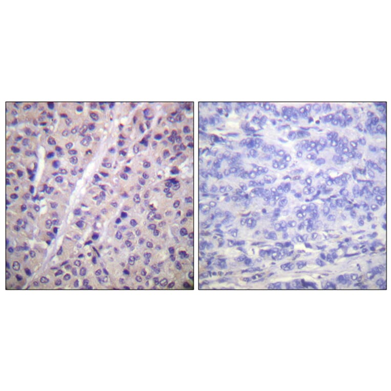 Immunohistochemistry - Anti-A-RAF (phospho Tyr302) Antibody (A0770) - Antibodies.com