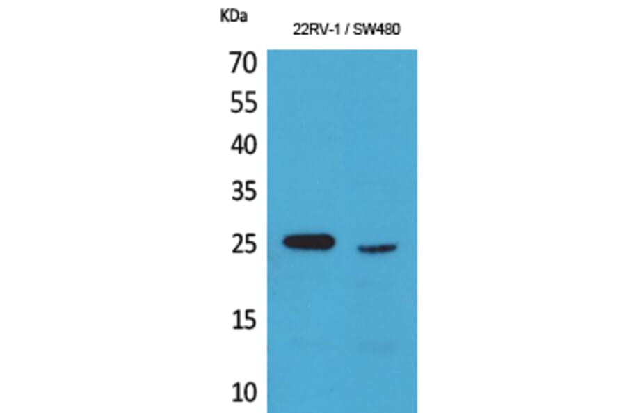 Western Blot - Anti-SSX1 + 2 + 3 + 4 + 5 + 6 + 7 + 8 + 9 Antibody (C30110) - Antibodies.com