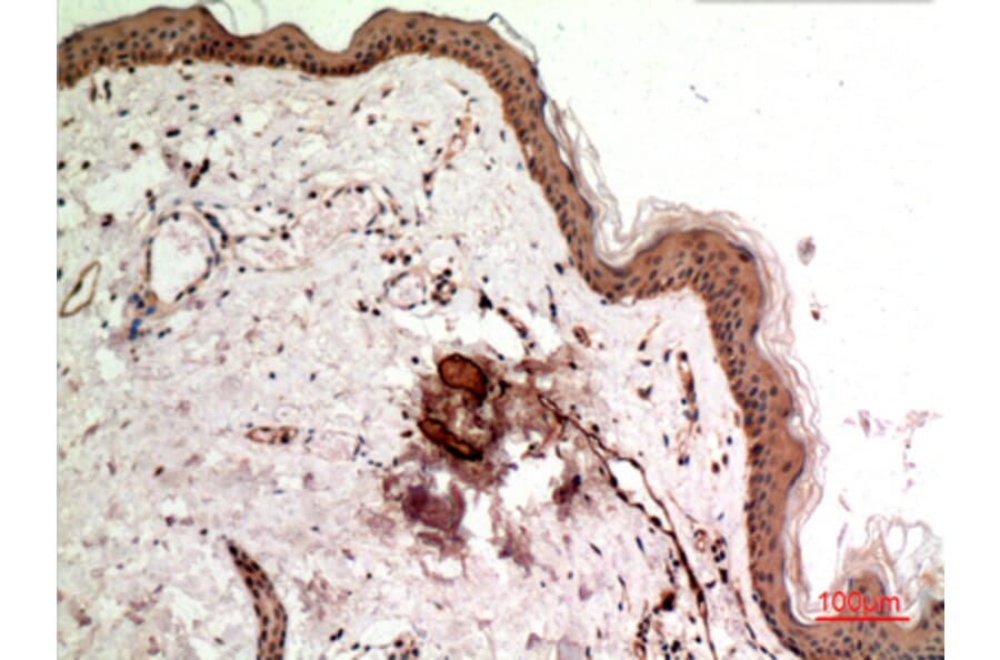 Immunohistochemistry - Anti-SSX1 + 2 + 3 + 4 + 5 + 6 + 7 + 8 + 9 Antibody (C30110) - Antibodies.com
