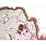 Immunohistochemistry - Anti-SSX1 + 2 + 3 + 4 + 5 + 6 + 7 + 8 + 9 Antibody (C30110) - Antibodies.com