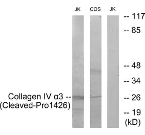 Western Blot - Anti-Collagen IV alpha3 (cleaved Pro1426) Antibody (L0228) - Antibodies.com