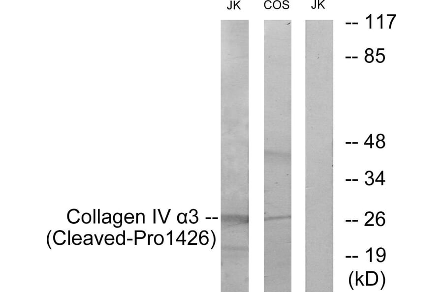 Western Blot - Anti-Collagen IV alpha3 (cleaved Pro1426) Antibody (L0228) - Antibodies.com