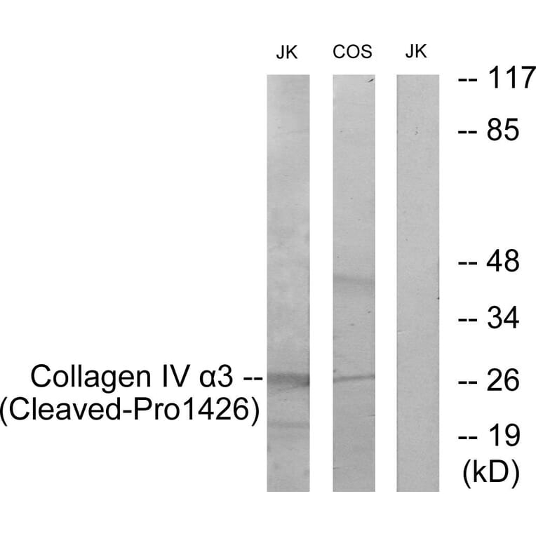 Western Blot - Anti-Collagen IV alpha3 (cleaved Pro1426) Antibody (L0228) - Antibodies.com