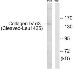 Western Blot - Anti-Collagen IV alpha3 (cleaved Leu1425) Antibody (L0227) - Antibodies.com