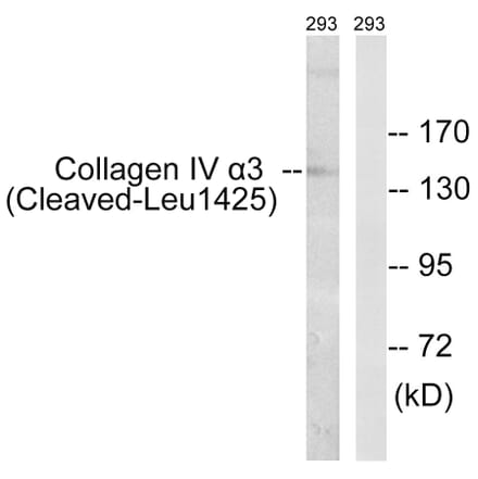 Western Blot - Anti-Collagen IV alpha3 (cleaved Leu1425) Antibody (L0227) - Antibodies.com