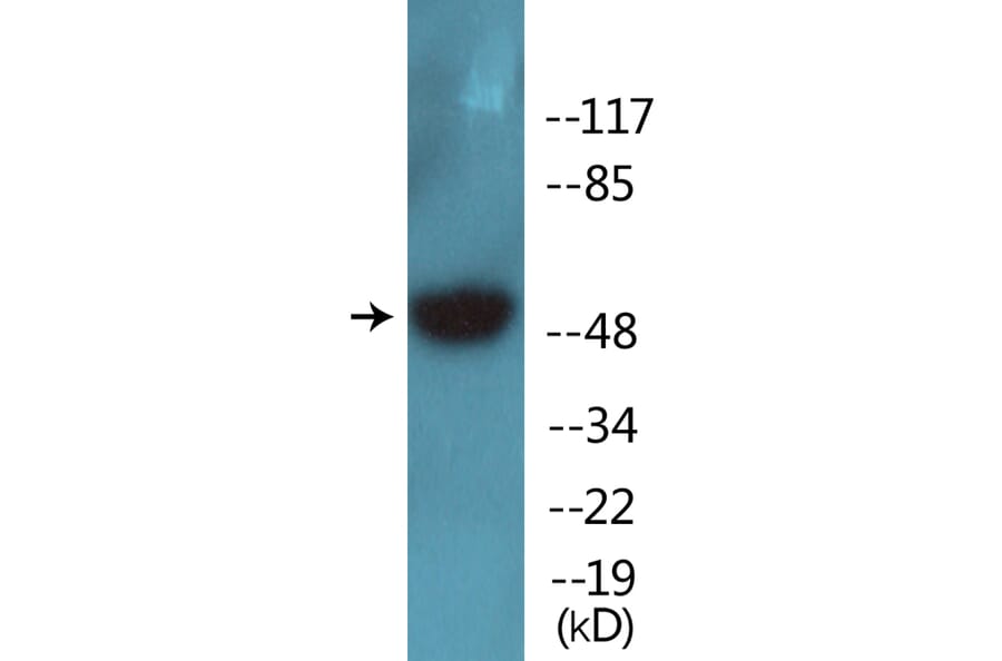 Western Blot - Anti-Breast Tumor Kinase (phospho Tyr447) Antibody (P12-1083) - Antibodies.com