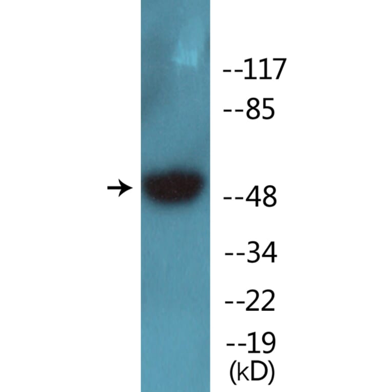 Western Blot - Anti-Breast Tumor Kinase (phospho Tyr447) Antibody (P12-1083) - Antibodies.com