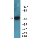Western Blot - Anti-Breast Tumor Kinase (phospho Tyr447) Antibody (P12-1083) - Antibodies.com