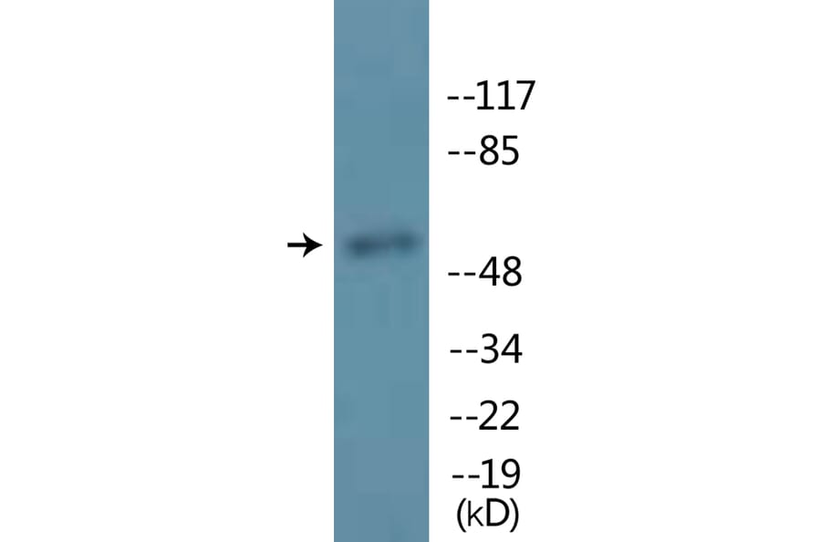 Western Blot - Anti-MITF (phospho Ser180 + Ser73) Antibody (P12-1149) - Antibodies.com