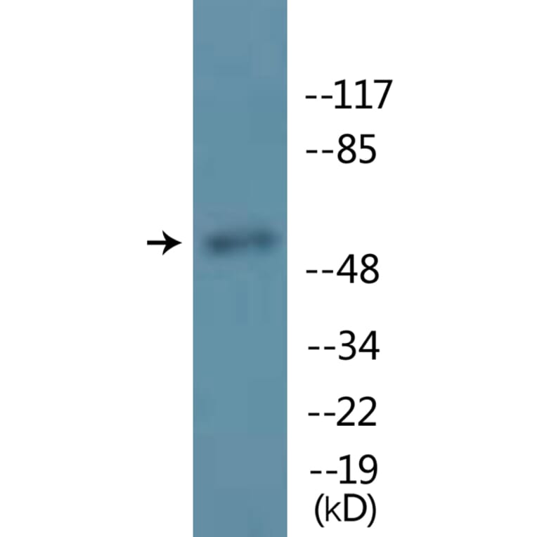 Western Blot - Anti-MITF (phospho Ser180 + Ser73) Antibody (P12-1149) - Antibodies.com