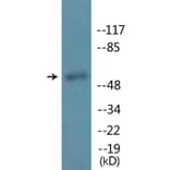 Western Blot - Anti-MITF (phospho Ser180 + Ser73) Antibody (P12-1149) - Antibodies.com