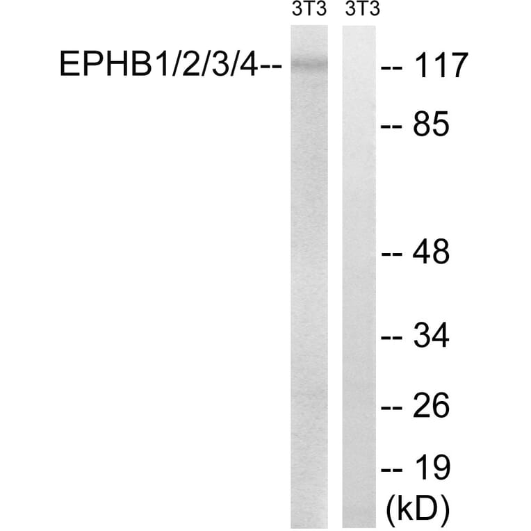 Western Blot - Anti-EPHB1 + EPHB2 + EPHB3 + EPHB4 Antibody (B8098) - Antibodies.com