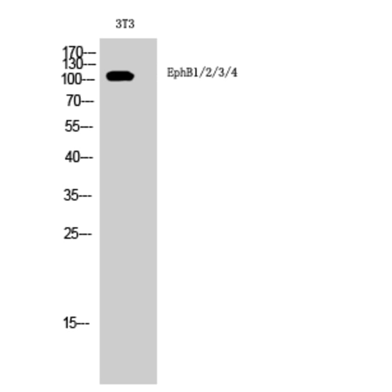 Western Blot - Anti-EPHB1 + EPHB2 + EPHB3 + EPHB4 Antibody (B8098) - Antibodies.com