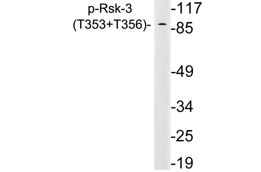 Western Blot - Anti-Rsk-3 (phospho Thr353+Thr356) Antibody (P12-1054) - Antibodies.com