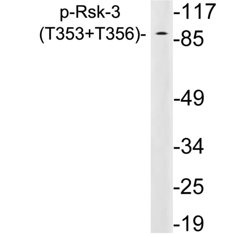 Western Blot - Anti-Rsk-3 (phospho Thr353+Thr356) Antibody (P12-1054) - Antibodies.com