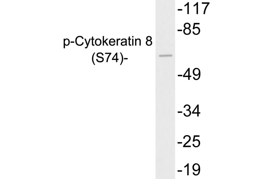 Western Blot - Anti-Cytokeratin 8 (phospho Ser74) Antibody (P12-1017) - Antibodies.com