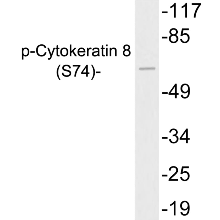 Western Blot - Anti-Cytokeratin 8 (phospho Ser74) Antibody (P12-1017) - Antibodies.com