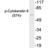 Western Blot - Anti-Cytokeratin 8 (phospho Ser74) Antibody (P12-1017) - Antibodies.com