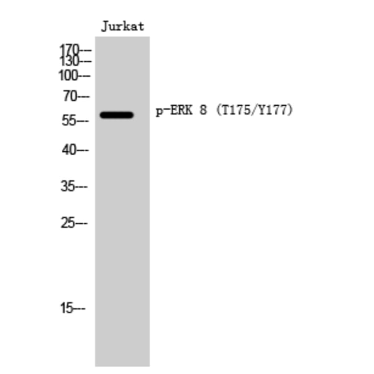 Western Blot - Anti-ERK8 (phospho Thr175+Tyr177) Antibody (A0920) - Antibodies.com