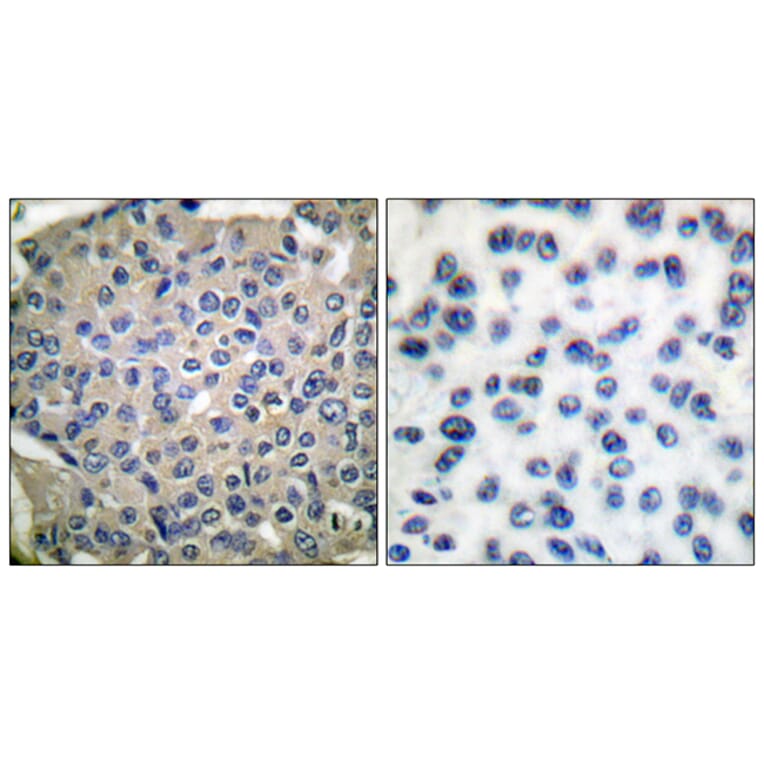 Immunohistochemistry - Anti-Cortactin (phospho Tyr466) Antibody (A7050) - Antibodies.com