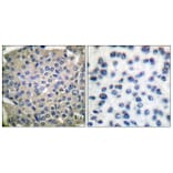 Immunohistochemistry - Anti-Cortactin (phospho Tyr466) Antibody (A7050) - Antibodies.com