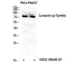 Western Blot - Anti-Cortactin (phospho Tyr466) Antibody (A7050) - Antibodies.com