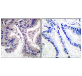 Immunohistochemistry - Anti-Caspase 6 (cleaved Asp162) Antibody (L0107) - Antibodies.com