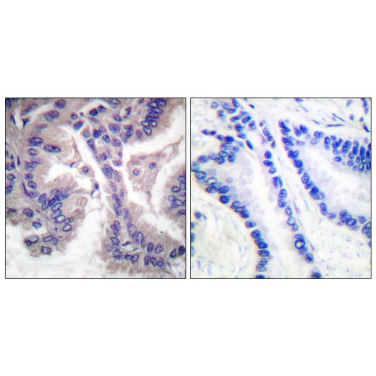 Immunohistochemistry - Anti-Caspase 6 (cleaved Asp162) Antibody (L0107) - Antibodies.com