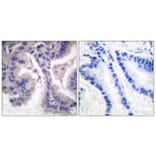 Immunohistochemistry - Anti-Caspase 6 (cleaved Asp162) Antibody (L0107) - Antibodies.com