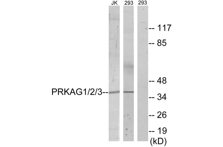 Western Blot - Anti-PRKAG1 + PRKAG2 + PRKAG3 Antibody (C10728) - Antibodies.com