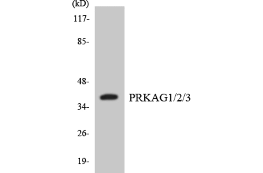 Western Blot - Anti-PRKAG1 + PRKAG2 + PRKAG3 Antibody (R12-3364) - Antibodies.com
