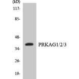 Western Blot - Anti-PRKAG1 + PRKAG2 + PRKAG3 Antibody (R12-3364) - Antibodies.com