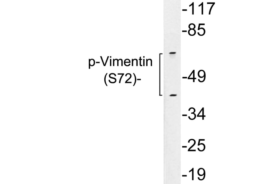 Western Blot - Anti-Vimentin (phospho Ser72) Antibody (P12-1066) - Antibodies.com