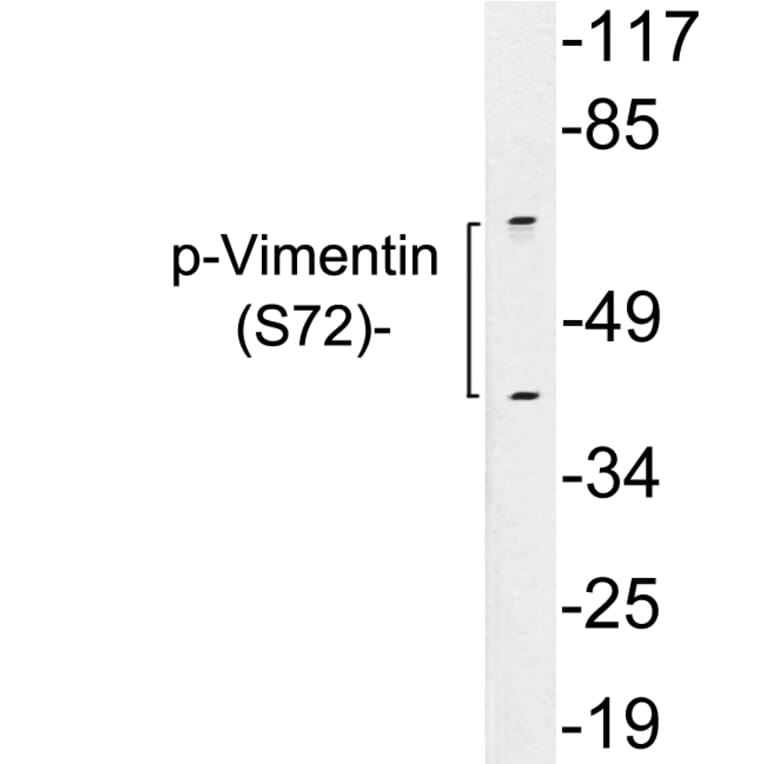 Western Blot - Anti-Vimentin (phospho Ser72) Antibody (P12-1066) - Antibodies.com