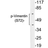 Western Blot - Anti-Vimentin (phospho Ser72) Antibody (P12-1066) - Antibodies.com