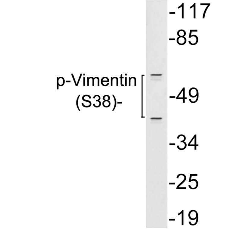 Western Blot - Anti-Vimentin (phospho Ser38) Antibody (P12-1065) - Antibodies.com