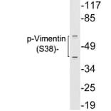 Western Blot - Anti-Vimentin (phospho Ser38) Antibody (P12-1065) - Antibodies.com