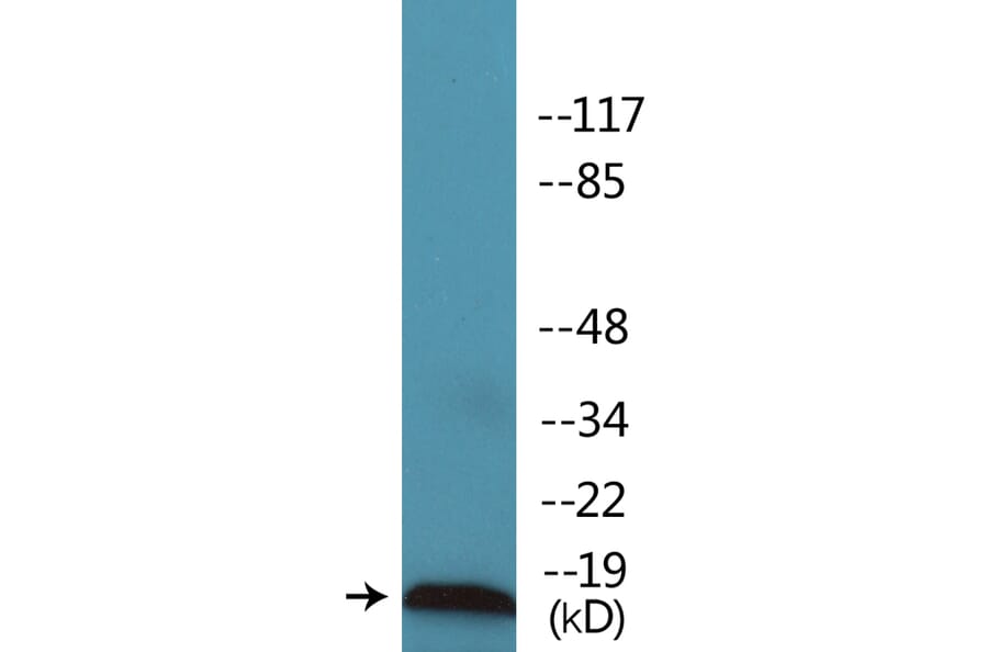 Western Blot - Anti-Survivin (phospho Thr34) Antibody (P12-1183) - Antibodies.com