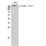 Western Blot - Anti-Pragmin (phospho Tyr413) Antibody (P12-1049) - Antibodies.com