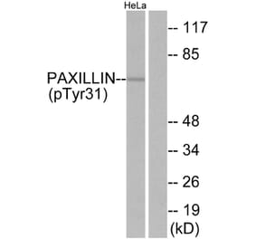 Western Blot - Anti-Paxillin (phospho Tyr31) Antibody (A7193) - Antibodies.com