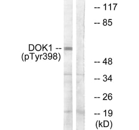 Western Blot - Anti-p62 Dok (phospho Tyr398) Antibody (A7058) - Antibodies.com