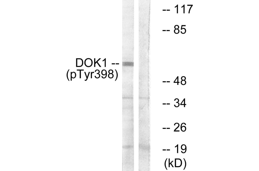 Western Blot - Anti-p62 Dok (phospho Tyr398) Antibody (A7058) - Antibodies.com