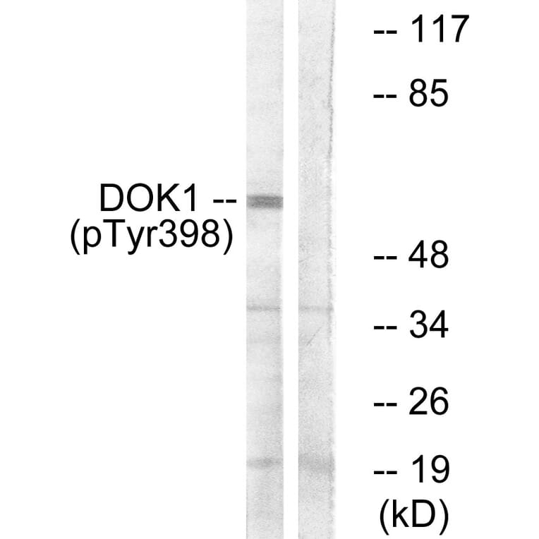 Western Blot - Anti-p62 Dok (phospho Tyr398) Antibody (A7058) - Antibodies.com