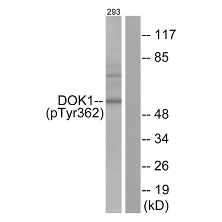 Western Blot - Anti-p62 Dok (phospho Tyr362) Antibody (A7057) - Antibodies.com