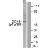 Western Blot - Anti-p62 Dok (phospho Tyr362) Antibody (A7057) - Antibodies.com
