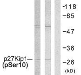 Western Blot - Anti-p27 Kip1 (phospho Ser10) Antibody (A7176) - Antibodies.com