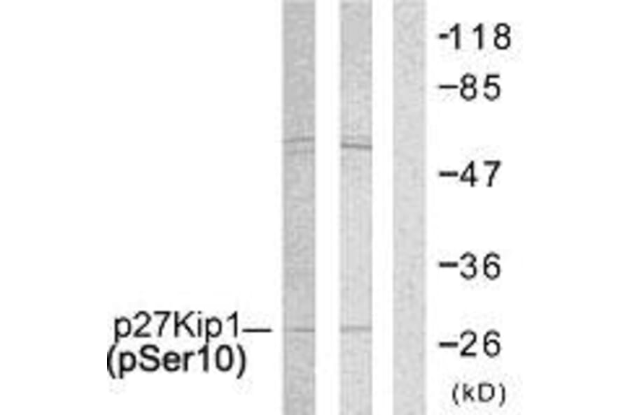 Western Blot - Anti-p27 Kip1 (phospho Ser10) Antibody (A7176) - Antibodies.com