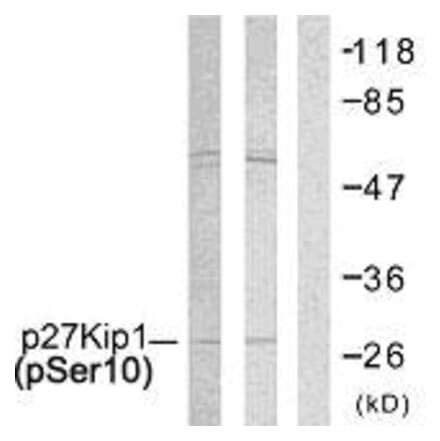 Western Blot - Anti-p27 Kip1 (phospho Ser10) Antibody (A7176) - Antibodies.com